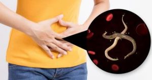 tratament naturist viermi intestinali