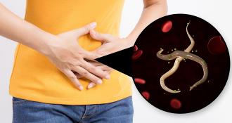 tratament naturist viermi intestinali