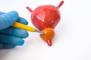 tratament prostata marita prostatita cronica